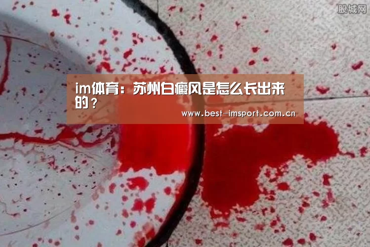 im体育：苏州白癜风是怎么长出来的？