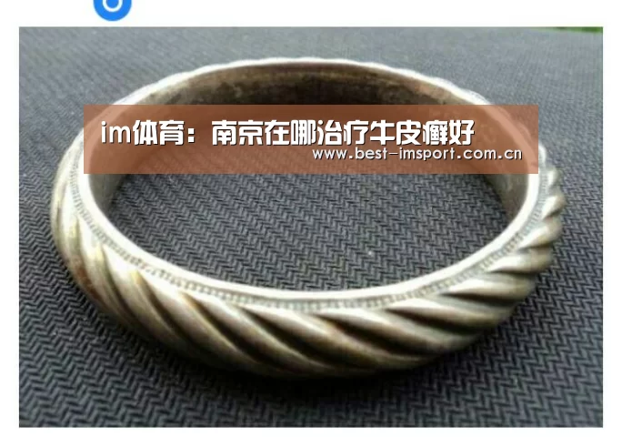 im体育：南京在哪治疗牛皮癣好