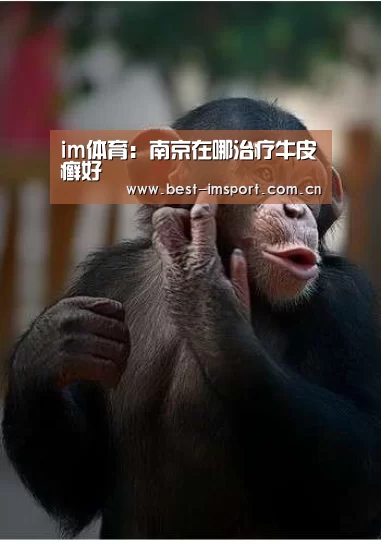 im体育:南京在哪治疗牛皮癣好(图2) im体育官网